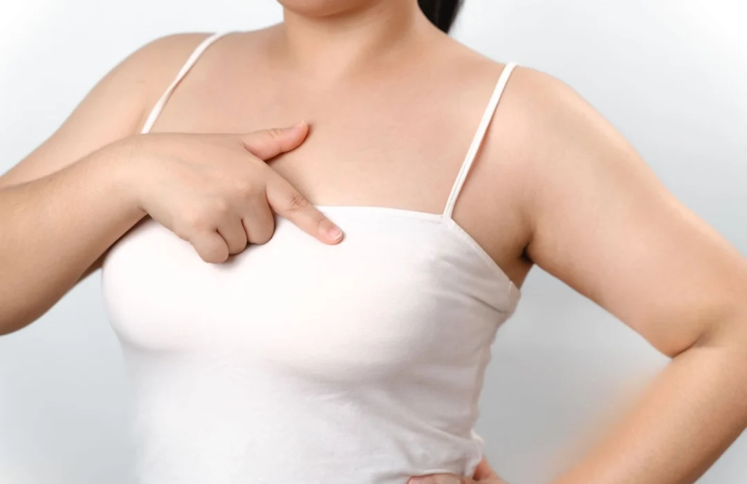 Breast Reconstruction India | Nipple Inversion Agra | Areola Repair
