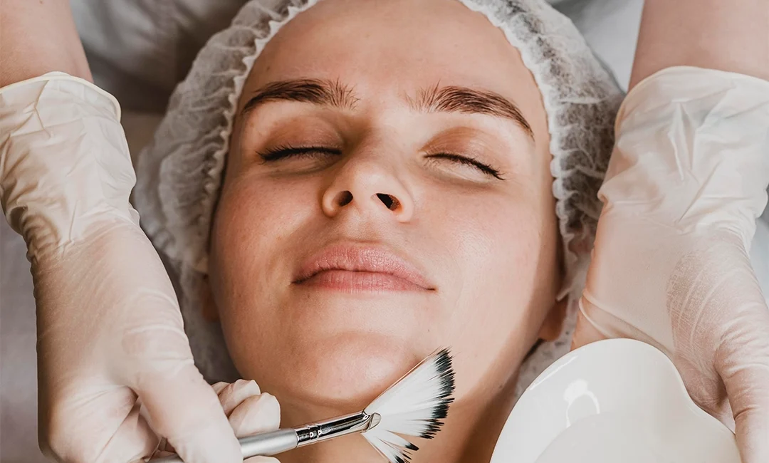 Chemical Peels: Types of Peels, Benefits, Cost | Saraswat Hospital