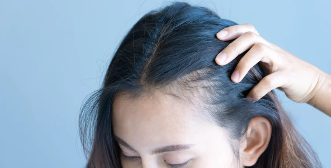 Long Hair Transplant Clinic in India | Saraswat Hospital