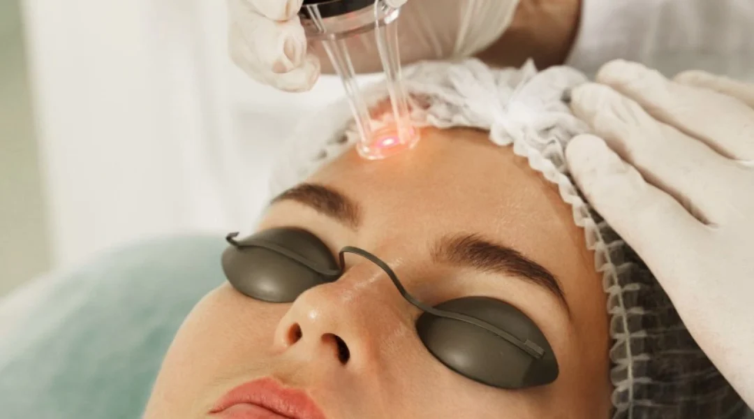 Cost of Laser Skin Resurfacing